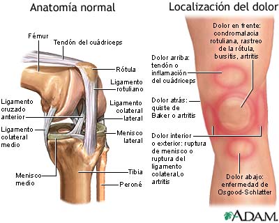 Problemas de rodilla en tijuana